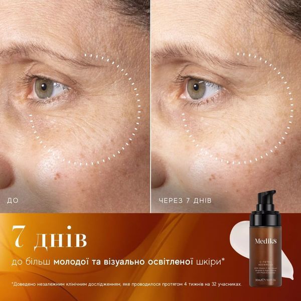 Гель-сироватка для освітлення та сяйва шкіри Medik8 C-Tetra Adva C-Tetra Advanced 30 ml 000128 фото